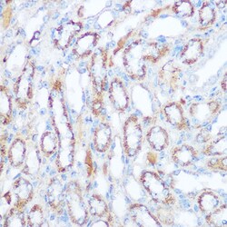 Invitrogen SIRT4 Polyclonal Antibody 100 &mu;L; Unconjugated:Antibodies,