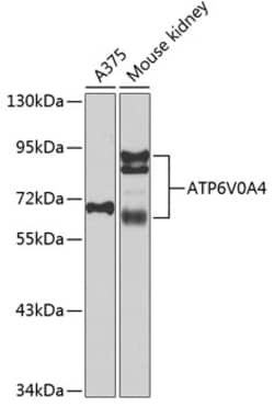 Invitrogen ATP6V0A4 Polyclonal Antibody 100 &mu;L; Unconjugated:Antibodies,