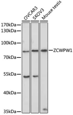 Invitrogen ZCWPW1 Polyclonal Antibody 100 &mu;L; Unconjugated:Antibodies,