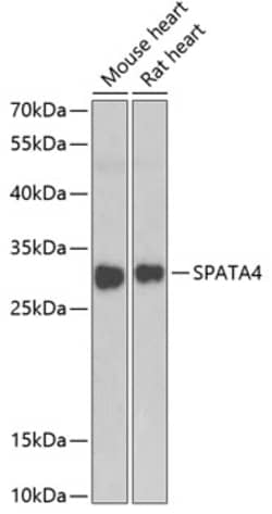 Invitrogen SPATA4 Polyclonal Antibody 100 &mu;L; Unconjugated:Antibodies,