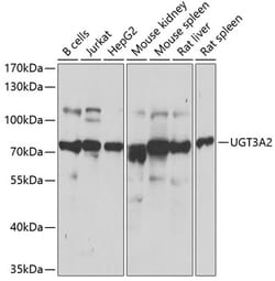 Invitrogen UGT3A2 Polyclonal Antibody 100 &mu;L; Unconjugated:Antibodies,
