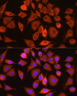 Invitrogen Bax Polyclonal Antibody 100 &mu;L | Buy Online | Invitrogen&trade; | Fisher Scientific