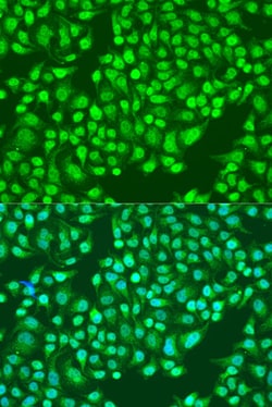 Invitrogen CD49b (Integrin alpha 2) Polyclonal Antibody 100 &mu;L; Unconjugated:Antibodies,