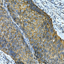 Invitrogen CD49b (Integrin alpha 2) Polyclonal Antibody 100 &mu;L; Unconjugated:Antibodies,