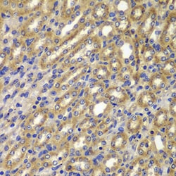 Invitrogen Cyclin A2 Polyclonal Antibody 100 &mu;L | Buy Online | Invitrogen&trade; | Fisher Scientific
