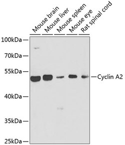 Invitrogen Cyclin A2 Polyclonal Antibody 100 &mu;L | Buy Online | Invitrogen&trade; | Fisher Scientific