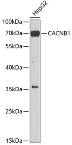 Invitrogen CACNB1 Polyclonal Antibody 100 &mu;L; Unconjugated:Antibodies,