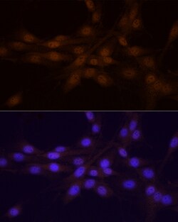 Invitrogen Chk1 Polyclonal Antibody 100 &mu;L; Unconjugated:Antibodies,