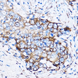Invitrogen Chk1 Polyclonal Antibody 100 &mu;L; Unconjugated:Antibodies,