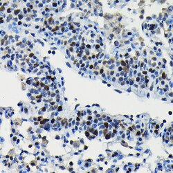 Invitrogen DRIL1 Polyclonal Antibody 100 &mu;L; Unconjugated:Antibodies,