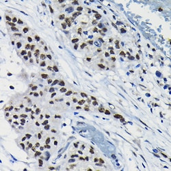 Invitrogen DRIL1 Polyclonal Antibody 100 &mu;L; Unconjugated:Antibodies,