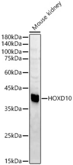Invitrogen HOXD10 Polyclonal Antibody 100 &mu;L; Unconjugated:Antibodies,