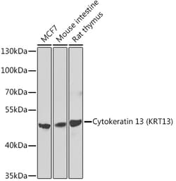 Cytokeratin 13 Polyclonal Antibody, Invitrogen 100 &mu;L; Unconjugated:Antibodies,