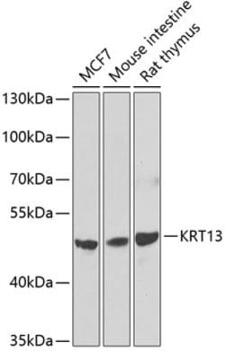 Cytokeratin 13 Polyclonal Antibody, Invitrogen 100 &mu;L; Unconjugated:Antibodies,