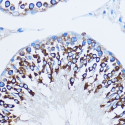 Invitrogen YBX1 Polyclonal Antibody 100 &mu;L; Unconjugated:Antibodies,