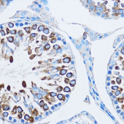 Invitrogen YBX1 Polyclonal Antibody 100 &mu;L; Unconjugated:Antibodies,