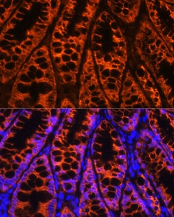 Invitrogen YBX1 Polyclonal Antibody 100 &mu;L; Unconjugated:Antibodies,