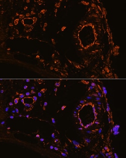 Invitrogen YBX1 Polyclonal Antibody 100 &mu;L; Unconjugated:Antibodies,