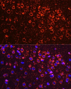 Invitrogen YBX1 Polyclonal Antibody 100 &mu;L; Unconjugated:Antibodies,
