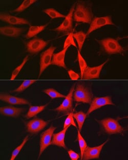 Invitrogen PGD Polyclonal Antibody 100 &mu;L | Buy Online | Invitrogen&trade; | Fisher Scientific