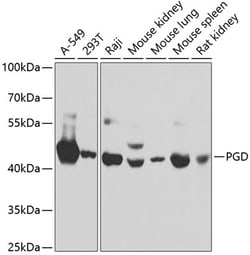 Invitrogen PGD Polyclonal Antibody 100 &mu;L | Buy Online | Invitrogen&trade; | Fisher Scientific