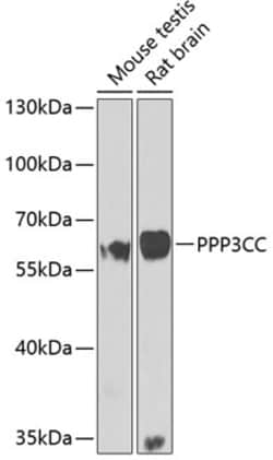 Invitrogen PPP3CC Polyclonal Antibody 100 &mu;L; Unconjugated:Antibodies,