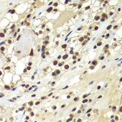 Invitrogen DNA-PK Polyclonal Antibody 100 &mu;L | Buy Online | Invitrogen&trade; | Fisher Scientific