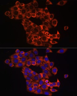Invitrogen SHH Polyclonal Antibody 100 &mu;L; Unconjugated:Antibodies,