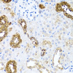 Invitrogen SHH Polyclonal Antibody 100 &mu;L; Unconjugated:Antibodies,
