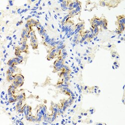 Invitrogen SHH Polyclonal Antibody 100 &mu;L; Unconjugated:Antibodies,
