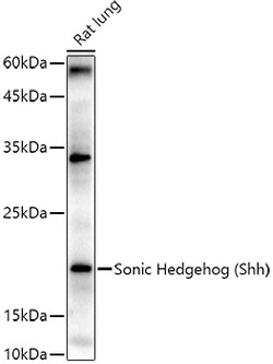 Invitrogen SHH Polyclonal Antibody 100 &mu;L; Unconjugated:Antibodies,