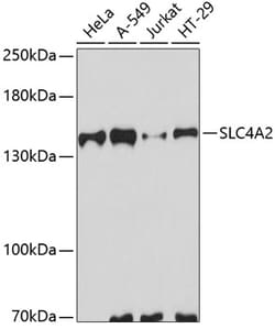 Invitrogen SLC4A2 Polyclonal Antibody 100 &mu;L; Unconjugated:Antibodies,