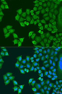 Synaptotagmin 4 Polyclonal Antibody, Invitrogen 100 &mu;L; Unconjugated:Antibodies,
