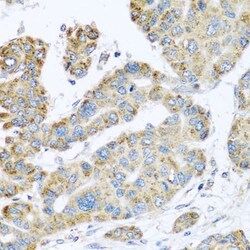 Synaptotagmin 4 Polyclonal Antibody, Invitrogen 100 &mu;L; Unconjugated:Antibodies,