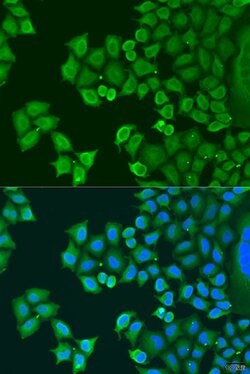 Synaptotagmin 4 Polyclonal Antibody, Invitrogen 100 &mu;L; Unconjugated:Antibodies,
