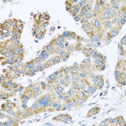Synaptotagmin 4 Polyclonal Antibody, Invitrogen 100 &mu;L; Unconjugated:Antibodies,