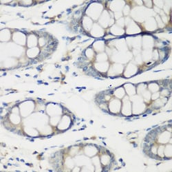 Invitrogen TNNC2 Polyclonal Antibody 100 &mu;L; Unconjugated:Antibodies,