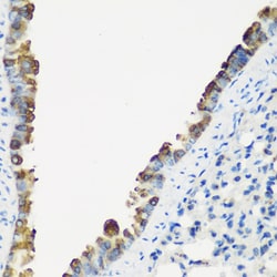 Invitrogen TNNC2 Polyclonal Antibody 100 &mu;L; Unconjugated:Antibodies,