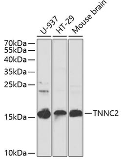 Invitrogen TNNC2 Polyclonal Antibody 100 &mu;L; Unconjugated:Antibodies,