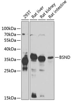 Invitrogen BSND Polyclonal Antibody 100 &mu;L | Buy Online | Invitrogen&trade; | Fisher Scientific