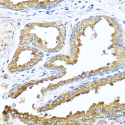 Invitrogen NCK2 Polyclonal Antibody 100 &mu;L; Unconjugated:Antibodies,