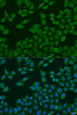 Invitrogen PLA2G4C Polyclonal Antibody 100 &mu;L; Unconjugated:Antibodies,