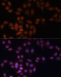 Invitrogen ADAM15 Polyclonal Antibody 100 &mu;L; Unconjugated:Antibodies,