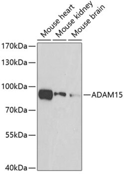 Invitrogen ADAM15 Polyclonal Antibody 100 &mu;L; Unconjugated:Antibodies,