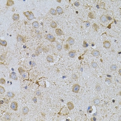 Invitrogen NAT8 Polyclonal Antibody 100 &mu;L; Unconjugated:Antibodies,