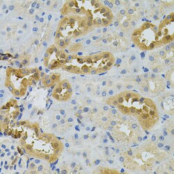 Invitrogen NAT8 Polyclonal Antibody 100 &mu;L; Unconjugated:Antibodies,