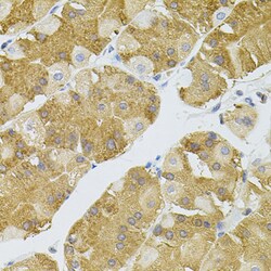 Invitrogen NAT8 Polyclonal Antibody 100 &mu;L; Unconjugated:Antibodies,