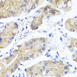 Invitrogen PSTPIP1 Polyclonal Antibody 100 &mu;L; Unconjugated:Antibodies,