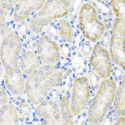 Invitrogen PSTPIP1 Polyclonal Antibody 100 &mu;L; Unconjugated:Antibodies,