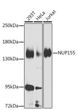 Invitrogen NUP155 Polyclonal Antibody 100 &mu;L; Unconjugated:Antibodies,
